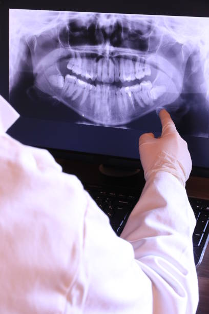 Best Emergency Treatment for Dental Infections or Abscesses in Willows, CA
